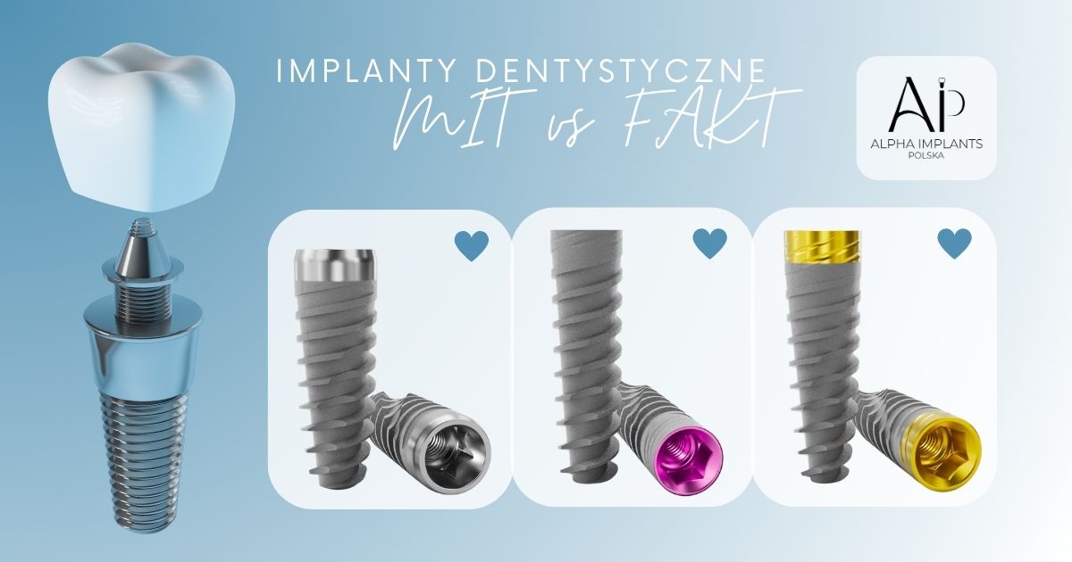 Implanty zębowe – fakty zamiast mitów