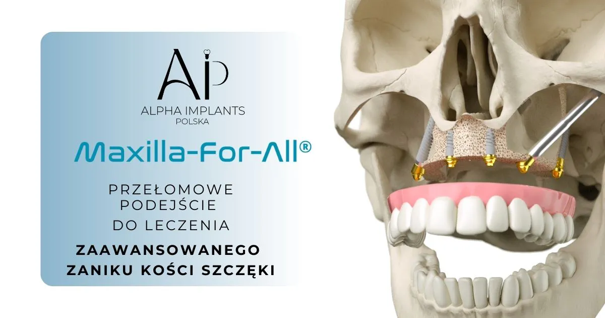 Maxilla-for-All®: Przełom w leczeniu bezzębia i zaawansowanego zaniku kości