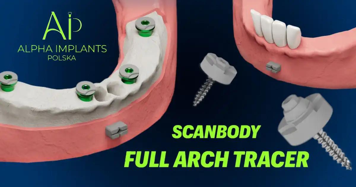 Full Arch Tracer: Precyzja i stabilność w cyfrowym projektowaniu pełnołukowych odbudów protetycznych