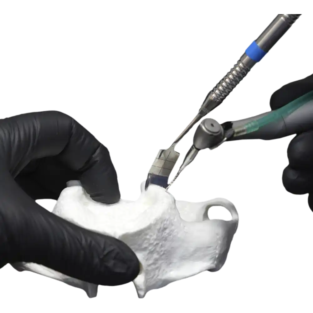 JDPterygo Retractor